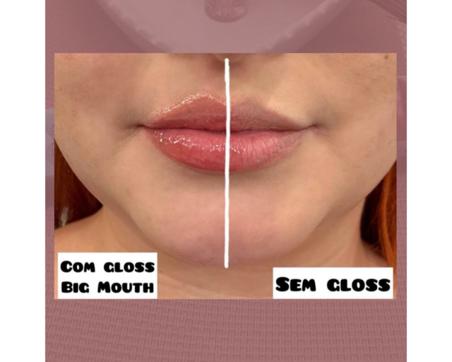 Gloss Labial Volumoso BIG MOUTH - Phállebeauty
